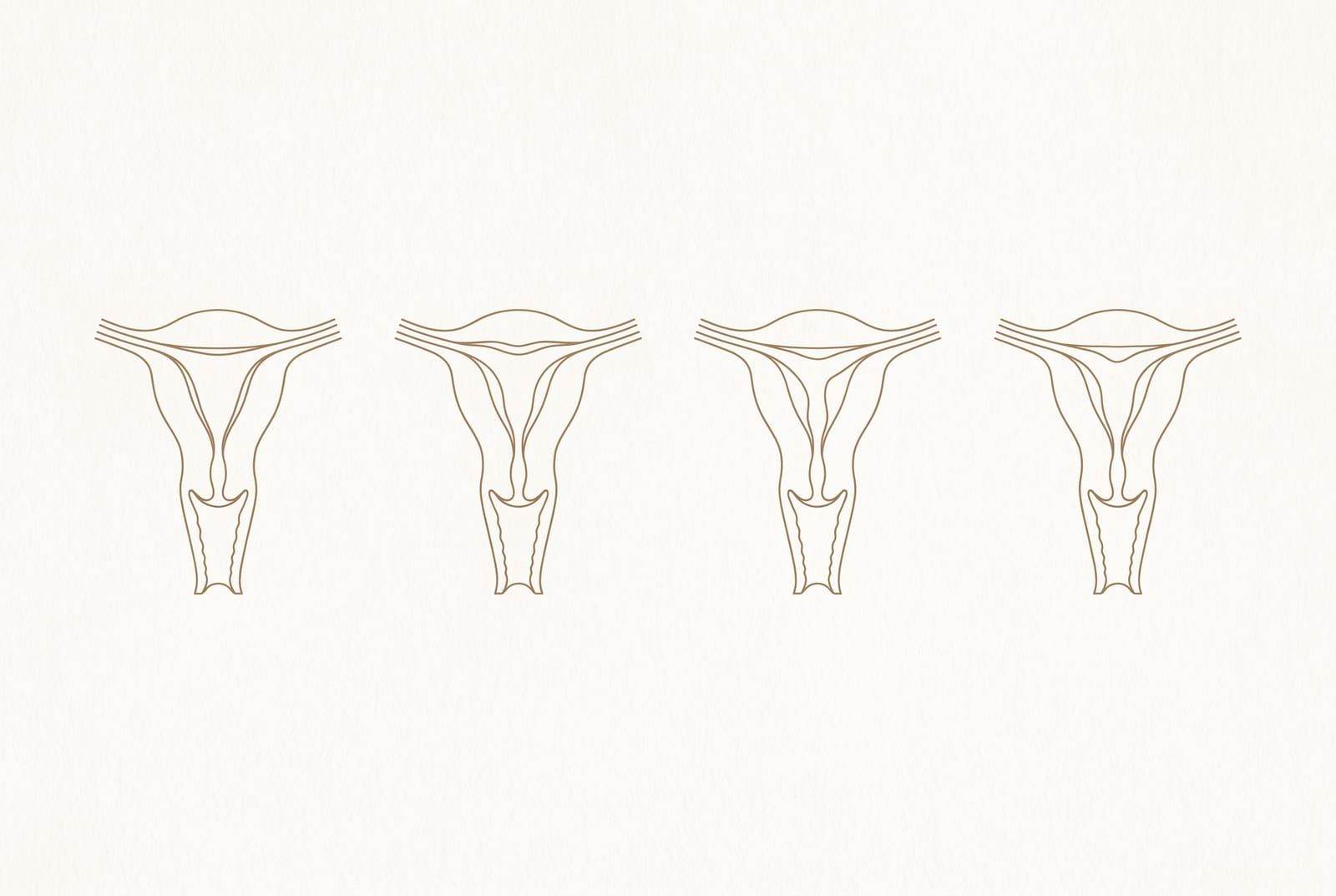 Ilustração com quatro silhuetas de útero lado a lado