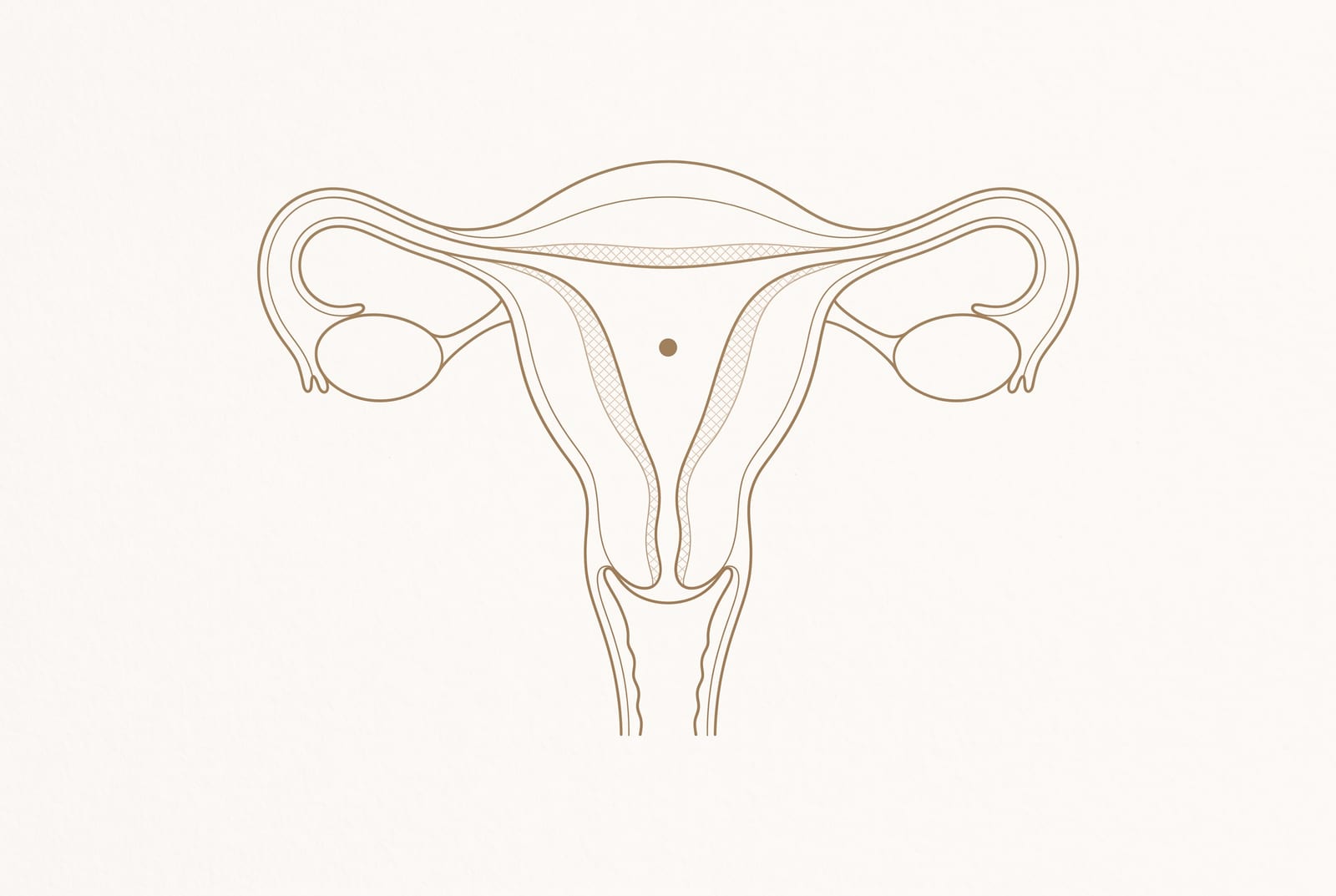 Ilustração do útero em corte, com o endométrio indicado